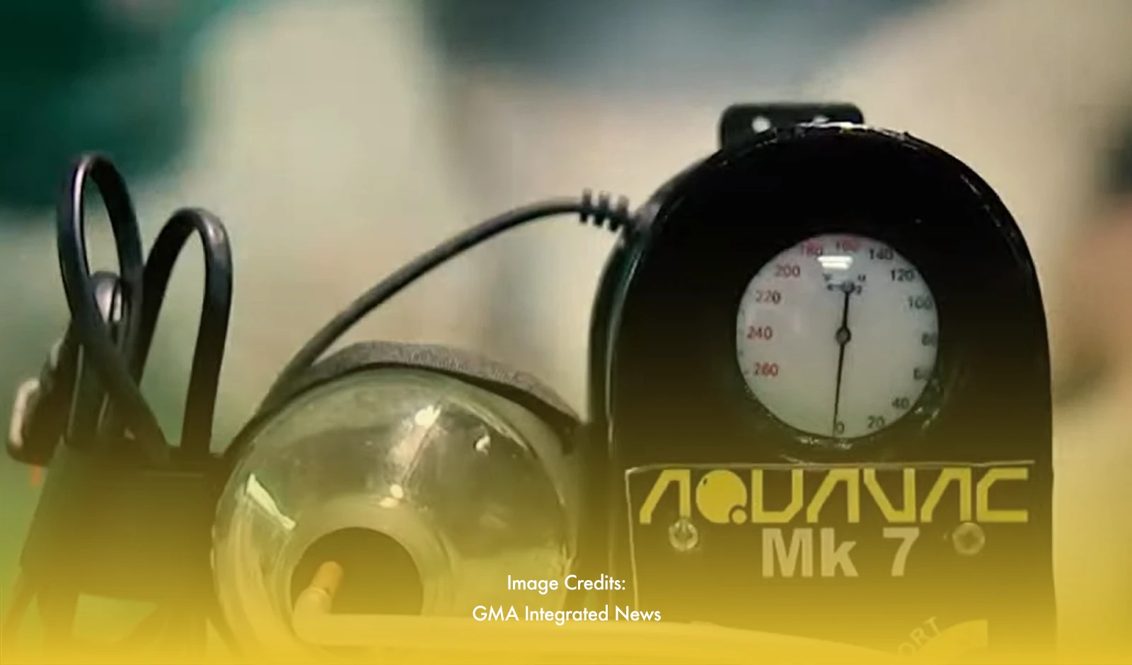 Bacolod Doctor Develops Affordable Wound Healing Device Using Aquarium Pump