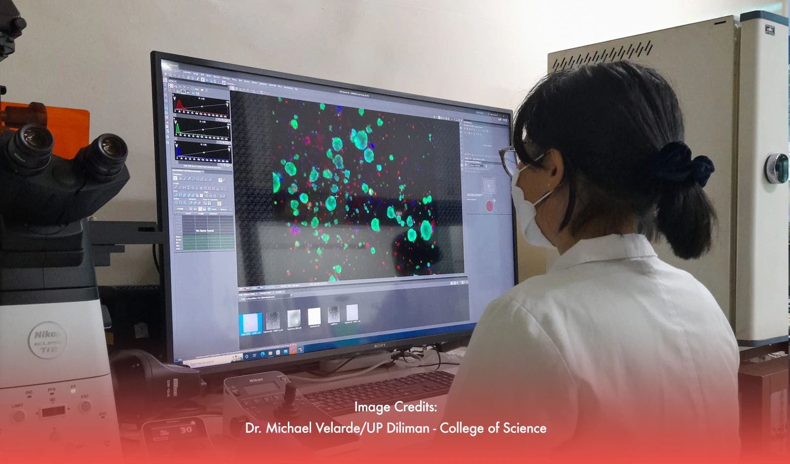 UP Scientists Pioneer Early Breast Cancer Test